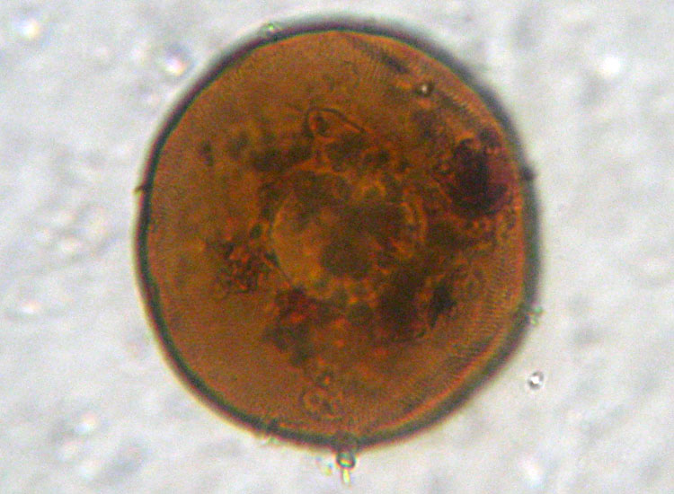 Arcella vulgaris